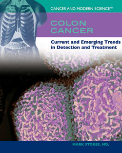 Colon Cancer | Rosen Publishing